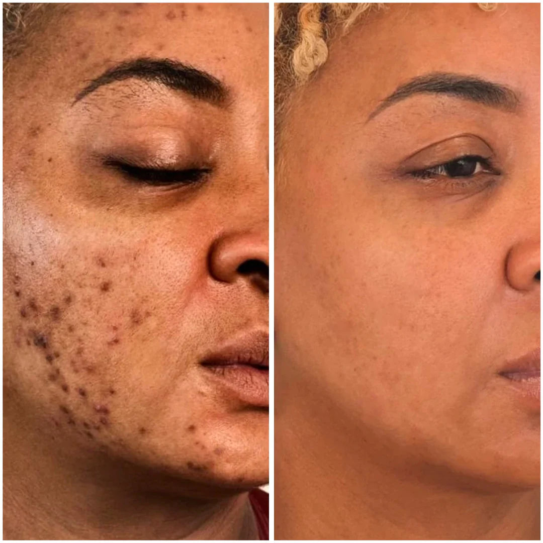 Dark Spot Brightening Cleansing Pad LPT1