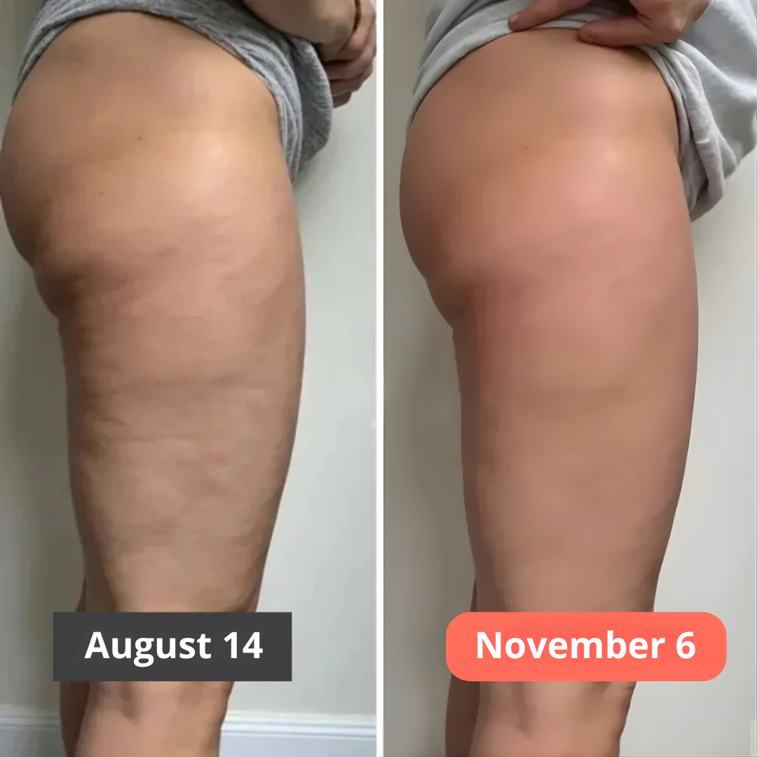 SkinForm™ – 3D Body-Contour Leggings