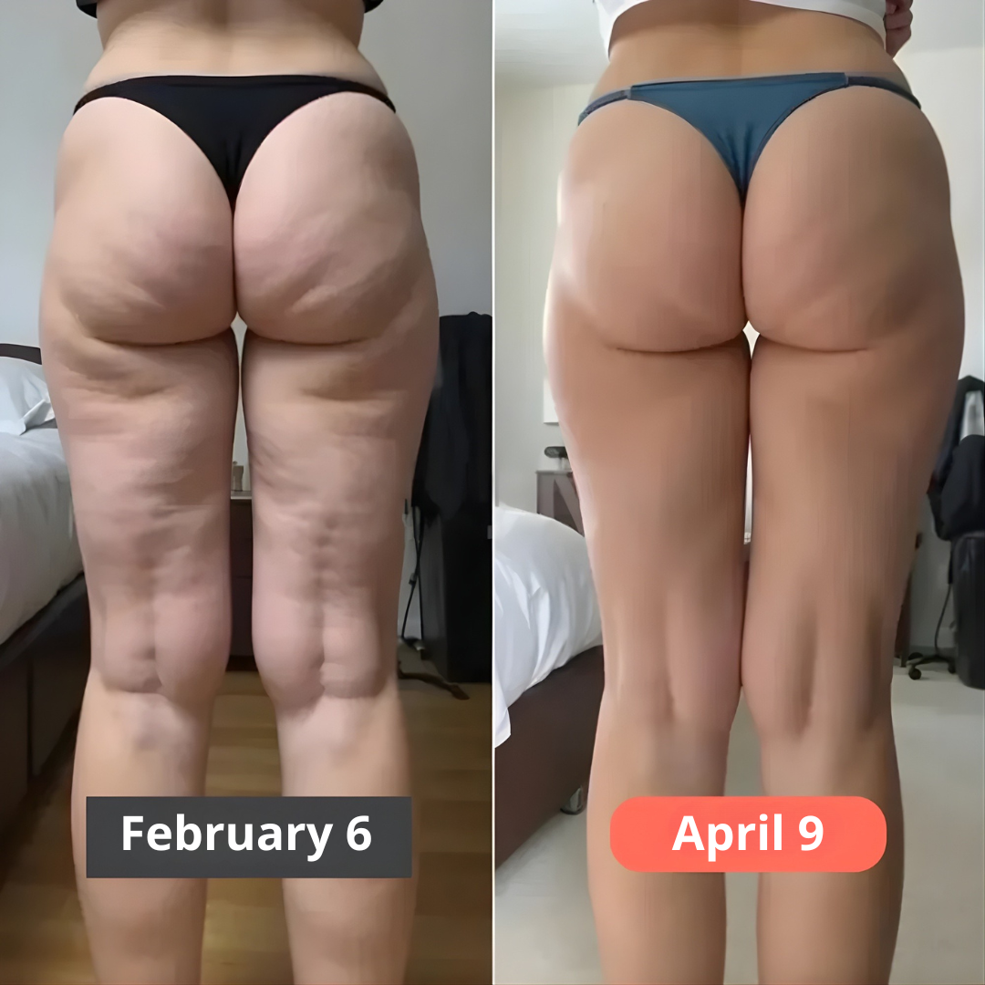 SkinForm™ – 3D Body-Contour Leggings