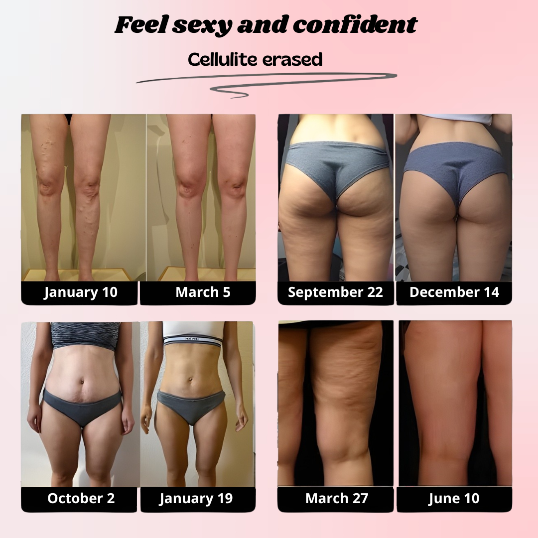 SkinForm™ – 3D Body-Contour Leggings
