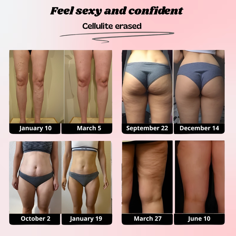 SkinForm™ – 3D Body-Contour Leggings