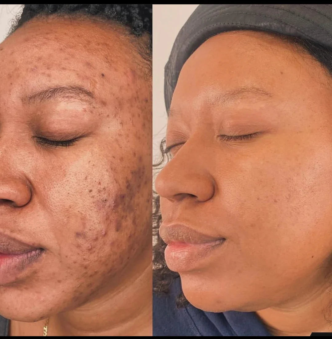 Dark Spot Brightening Cleansing Pad LPT1