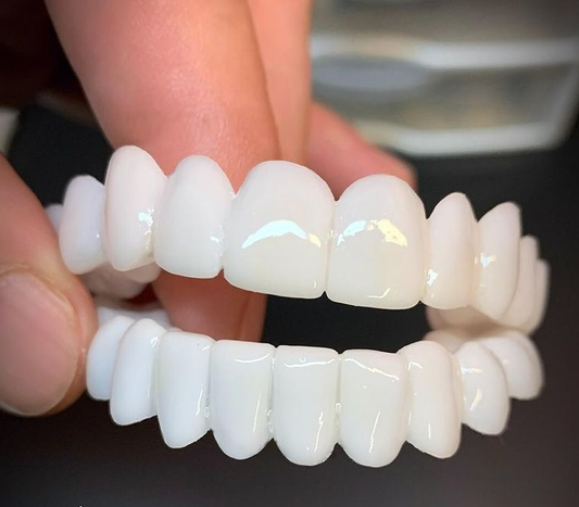 Licówki Dentystyczne DentAlign – Naturalne Dopasowanie i Wygoda 0