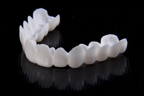 Licówki Dentystyczne DentAlign – Naturalne Dopasowanie i Wygoda 5