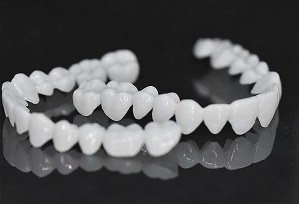 Licówki Dentystyczne DentAlign – Naturalne Dopasowanie i Wygoda 6