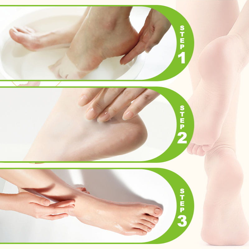 SoftStep™ Moisturizing and Anti-Crack Foot Cream